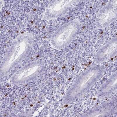 Immunohistochemistry-Paraffin: Granulysin Antibody [NBP2-38839]