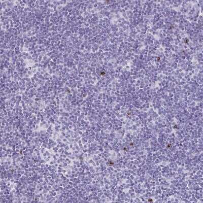 Immunohistochemistry-Paraffin: Granulysin Antibody [NBP2-38839]