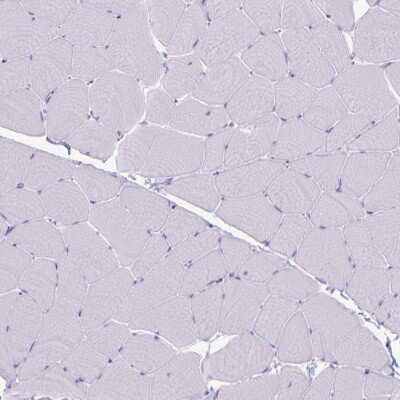 Immunohistochemistry-Paraffin: Granulysin Antibody [NBP2-38839]