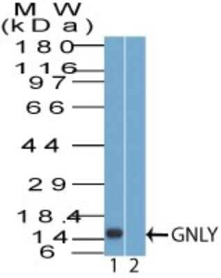 Western Blot: Granulysin Antibody [NBP2-27101]