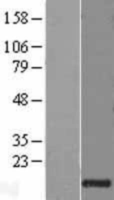 Western Blot: Granulysin Overexpression Lysate [NBL1-11185]