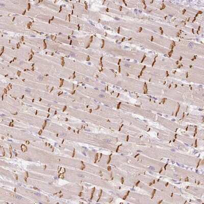 Immunohistochemistry-Paraffin: Granzyme A Antibody [NBP2-38717]