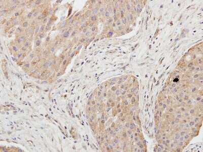 Immunohistochemistry-Paraffin: Granzyme A Antibody [NBP2-16736]