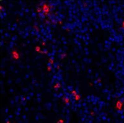 Immunohistochemistry: Granzyme B Antibody (BLR022E) [NBP2-76414]