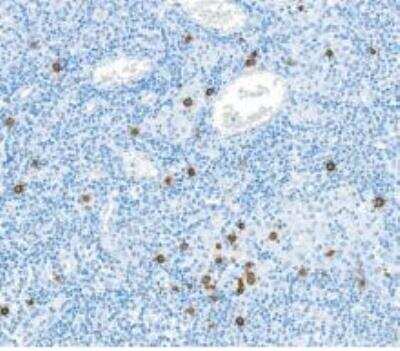 Immunohistochemistry-Paraffin: Granzyme B Antibody (BLR022E) [NBP2-76414]