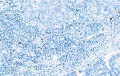 Immunohistochemistry-Paraffin: Granzyme B Antibody (BLR022E) [NBP2-76414]