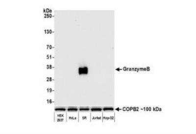 Western Blot: Granzyme B Antibody (BLR022E) [NBP2-76414]
