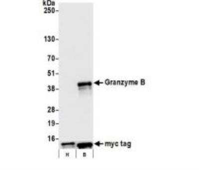 Western Blot: Granzyme B Antibody (BLR022E) [NBP2-76414]