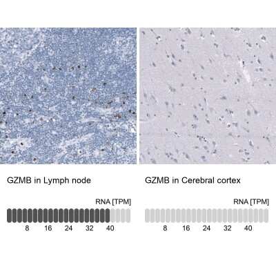 Immunohistochemistry-Paraffin: Granzyme B Antibody (CL10662) [NBP3-07984]