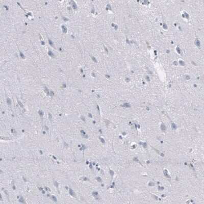 Immunohistochemistry-Paraffin: Granzyme B Antibody (CL10662) [NBP3-07984]