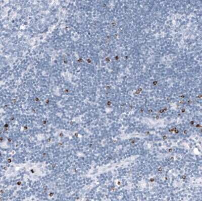 Immunohistochemistry-Paraffin: Granzyme B Antibody (CL10662) [NBP3-07984]