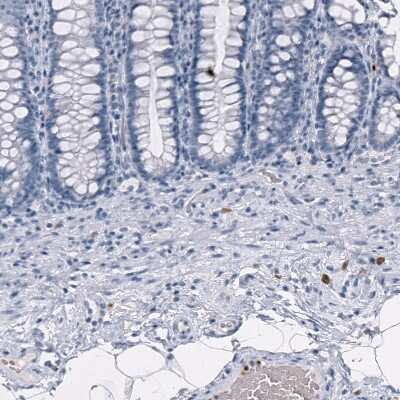 Immunohistochemistry-Paraffin: Granzyme B Antibody (CL10662) [NBP3-07984]