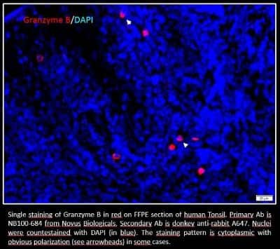 Immunocytochemistry/ Immunofluorescence: Granzyme B Antibody [NB100-684]