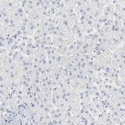 Immunohistochemistry-Paraffin: Granzyme B Antibody [NBP1-88151]