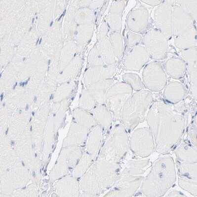 Immunohistochemistry-Paraffin: Granzyme B Antibody [NBP1-88151]