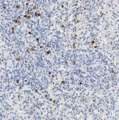 Immunohistochemistry-Paraffin: Granzyme B Antibody [NBP1-88151]