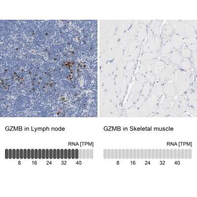 Immunohistochemistry-Paraffin: Granzyme B Antibody [NBP1-88151]