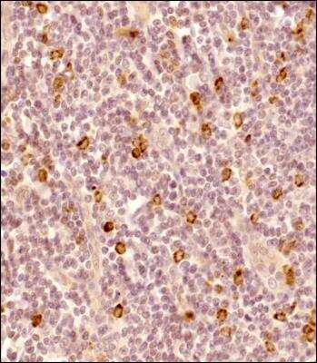 Immunohistochemistry-Paraffin: Granzyme B Antibody - BSA Free [NBP2-59678]