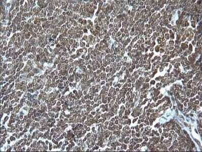 Immunohistochemistry: Granzyme B Antibody (OTI4E4) - Azide and BSA Free [NBP2-70870]