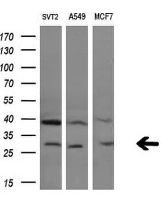Western Blot: Granzyme B Antibody (OTI4E4)Azide and BSA Free [NBP2-70870]