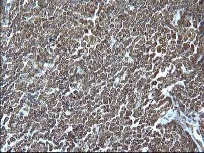 Immunohistochemistry: Granzyme B Antibody (OTI4E4) [NBP2-45732]