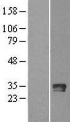 Western Blot: Granzyme B Overexpression Lysate [NBL1-11417]