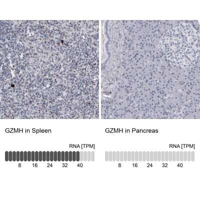 Immunohistochemistry-Paraffin: Granzyme H Antibody [NBP1-86565]