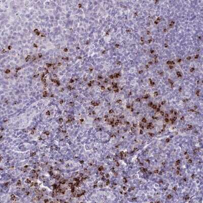 Immunohistochemistry-Paraffin: Granzyme K Antibody [NBP2-49387]