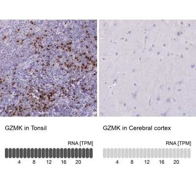 Immunohistochemistry-Paraffin: Granzyme K Antibody [NBP2-49387]