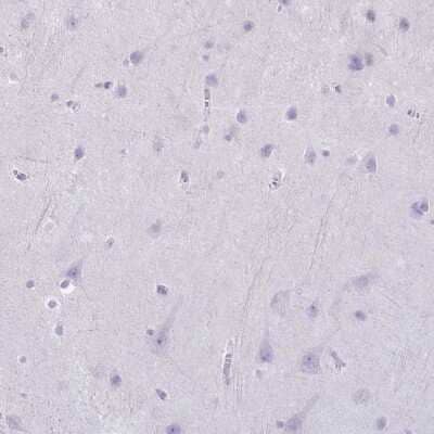 Immunohistochemistry-Paraffin: Granzyme K Antibody [NBP2-49387]