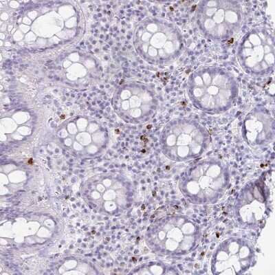 Immunohistochemistry-Paraffin: Granzyme K Antibody [NBP2-49387]