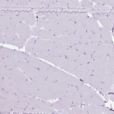 Immunohistochemistry-Paraffin: Granzyme K Antibody [NBP2-49387]