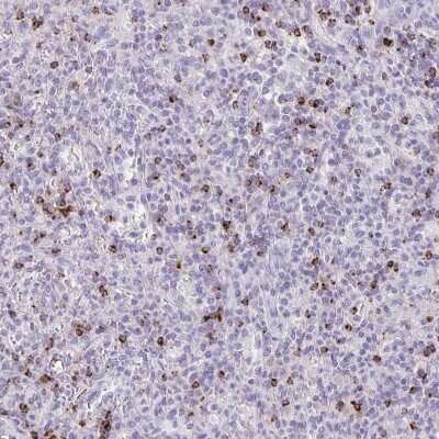 Immunohistochemistry-Paraffin: Granzyme K Antibody [NBP2-49387]