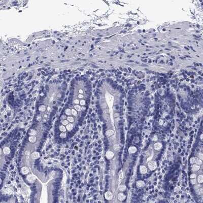 Immunohistochemistry-Paraffin: Granzyme K Antibody [NBP3-17052]