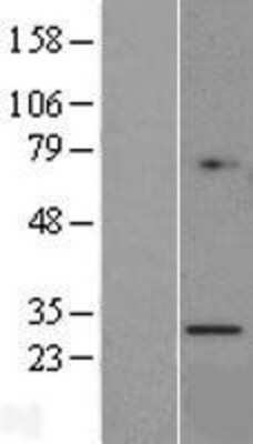 Western Blot: Granzyme K Overexpression Lysate [NBL1-11419]