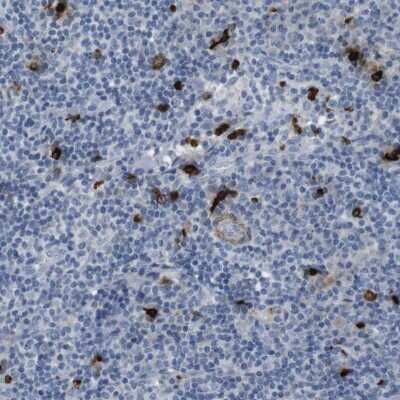 Immunohistochemistry-Paraffin: Granzyme M Antibody [NBP2-14079]