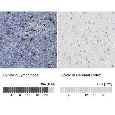 Immunohistochemistry-Paraffin: Granzyme M Antibody [NBP2-14079]