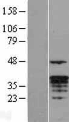 Western Blot: Granzyme M Overexpression Lysate [NBL1-11420]