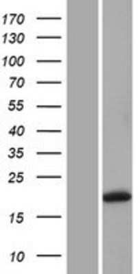 Western Blot: Gremlin 1 Overexpression Lysate [NBP2-10342]