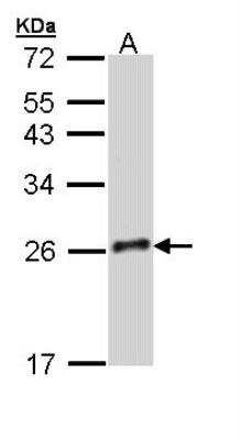 Western Blot: Growth Hormone 2 Antibody [NBP1-33321]