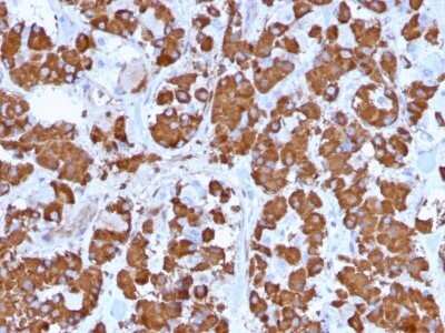 Immunohistochemistry-Paraffin: Growth Hormone Antibody (GH/1371) - Azide and BSA Free [NBP2-54361]