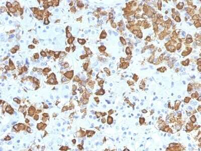 Immunohistochemistry-Paraffin: Growth Hormone Antibody (GH/1371) [NBP2-53261]