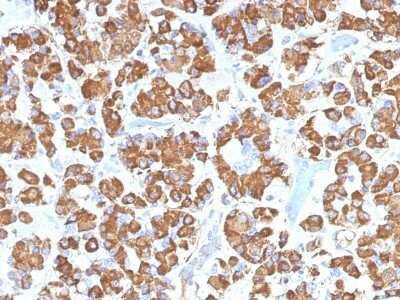 Immunohistochemistry-Paraffin: Growth Hormone Antibody (GH/1450) [NBP2-53262]