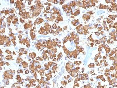 Immunohistochemistry-Paraffin: Growth Hormone Antibody (GH/1450) - Azide and BSA Free [NBP2-54356]