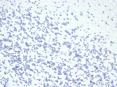 Immunohistochemistry-Paraffin: Growth Hormone Antibody (GH/4886R) [NBP3-13925]