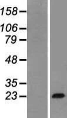 Western Blot: Growth Hormone Overexpression Lysate [NBP2-10676]