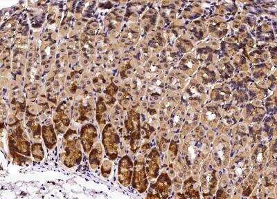 Immunohistochemistry-Paraffin: Growth Hormone R Antibody (008) [NBP2-90374]