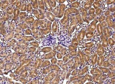 Immunohistochemistry-Paraffin: Growth Hormone R Antibody (008) [NBP2-90374]