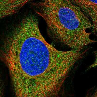 Immunocytochemistry/ Immunofluorescence: Growth Hormone R Antibody [NBP2-55524]