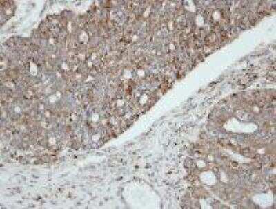 Immunohistochemistry: Growth Hormone R Antibody [NBP1-31420]